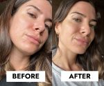شوینده ضد جوش سراوی |Blemish Control | پوست های مختلط،چرب،مستعد به جوش و لک | 236ml - Image 4