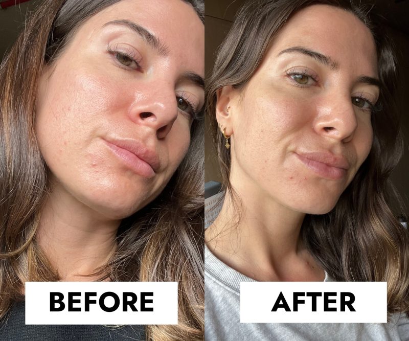 شوینده ضد جوش سراوی |Blemish Control | پوست های مختلط،چرب،مستعد به جوش و لک | 236ml - Image 4