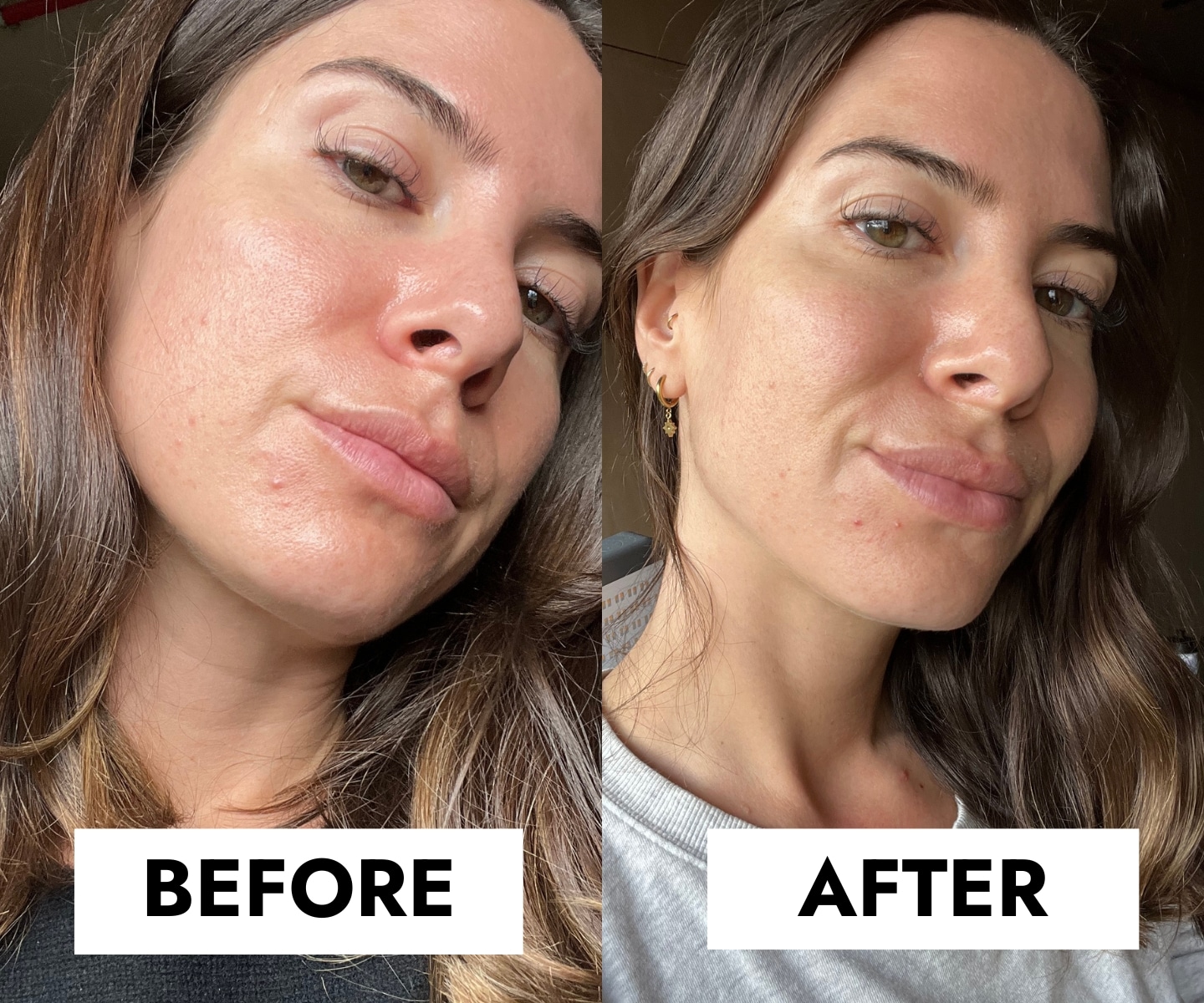 xr:d:DAFA6j7fFZA:221,j:8185685600223200835,t:23061307 شوینده ضد جوش سراوی |Blemish Control | پوست های مختلط،چرب،مستعد به جوش و لک | 236ml - Image 4
